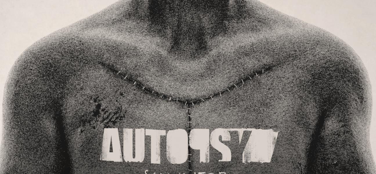 أوتوبسي سموليتر